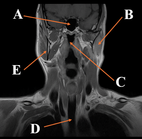 Labeled MRI Anatomy